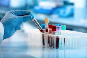 Read more about the article What Labs Should Adults Get Yearly?