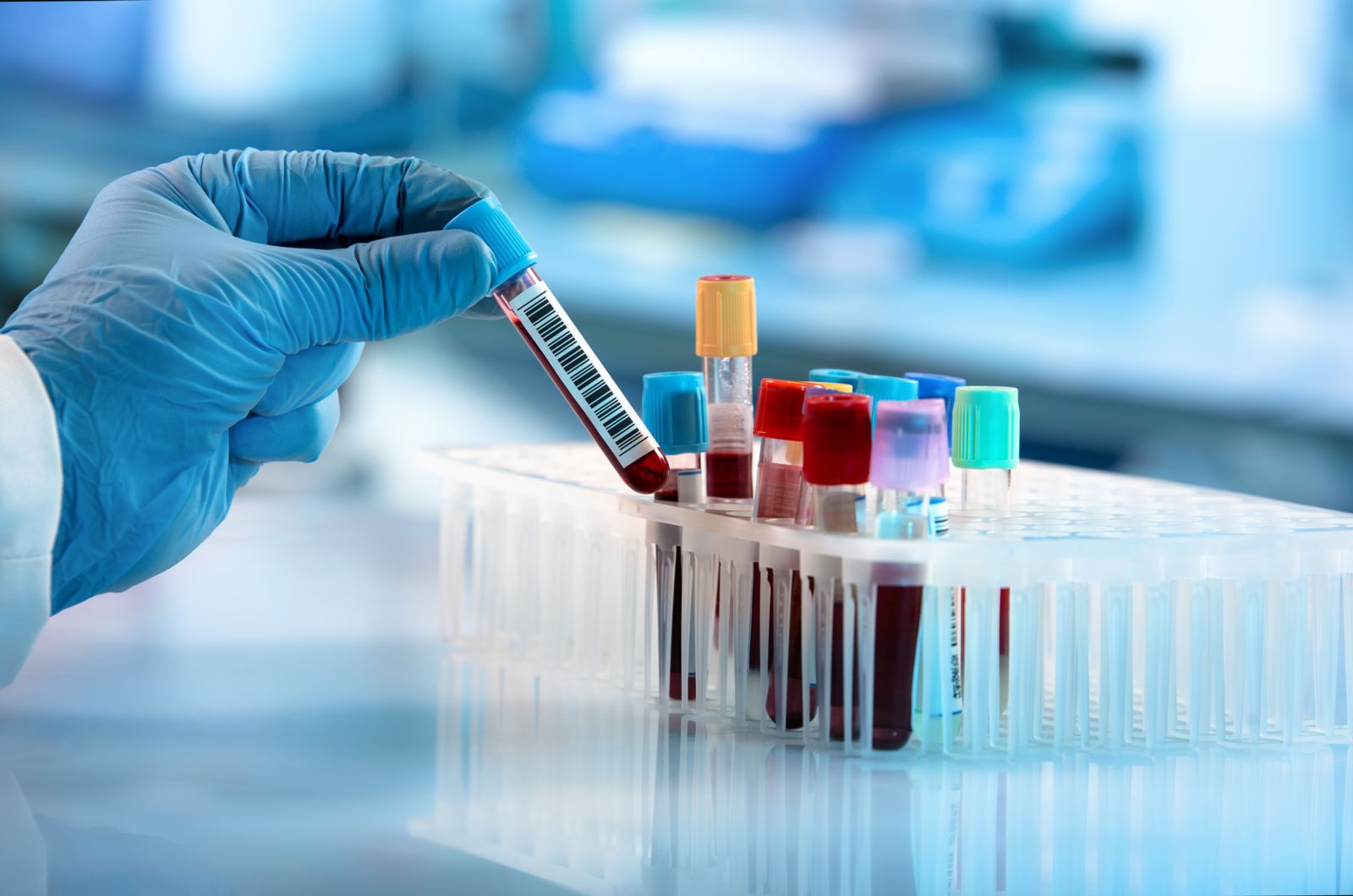 You are currently viewing What Labs Should Adults Get Yearly?